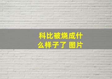 科比被烧成什么样子了 图片